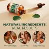 imageKUKKA essential oils 100 Pure ampamp Natural Peppermint Oil for Skin Hair Diffuser ampamp Soap Making DIY4 Fl Oz118 mlEucalyptus