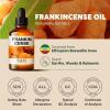 imageKukka Basil Essential Oil for Diffusers  4 Fl Oz  100 Pure Natural Basil Oil for Skin ampamp Aromatherapy Scent Massage Candles ampamp Soaps Making ScentFrankincense
